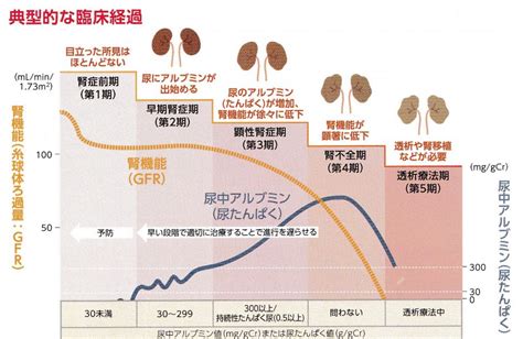 片腎寿命: 片腎疾患後の予後を知る