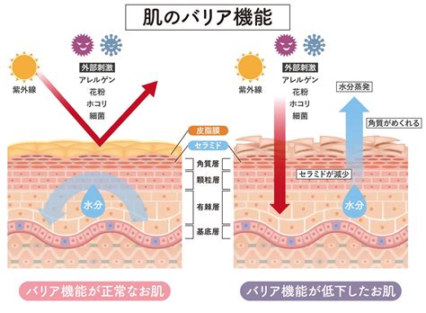 皮膚のバリア機能が低下することで起こる炎症性皮膚疾患