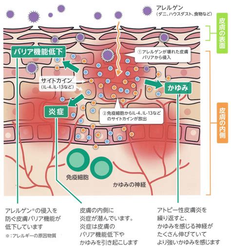 皮膚の炎症：