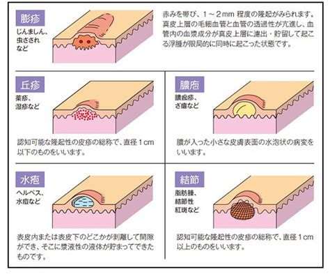 皮膚の状態