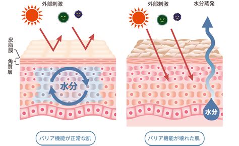 皮膚バリア機能を守ることで健康的な肌を保つスキンガードに関する包括ガイド