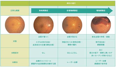 目の病気の分類