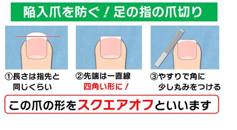 看護師にとっての爪の長さ：感染予防と患者ケアの最適化