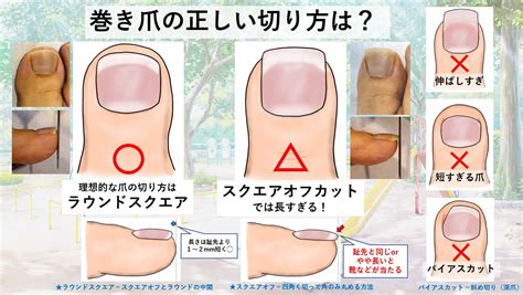 看護師の爪の長さに関するガイドライン