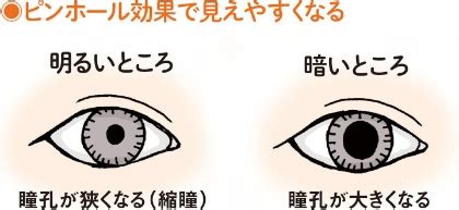 瞳孔が縦長になる理由と治療法