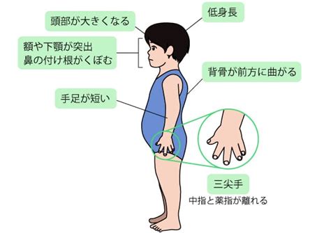 短縮四肢による問題：