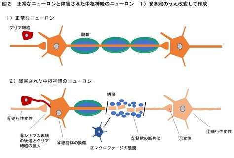 神経系の障害