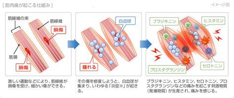 筋肉の緊張と痛みの緩和: