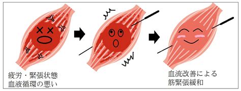 筋肉の緊張緩和：