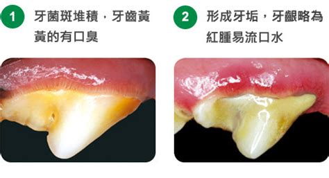 綠潔齒骨：潛藏的危險