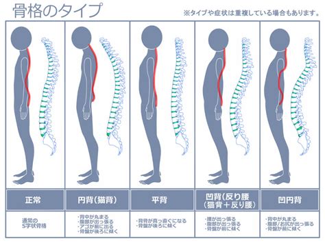 背骨が出たやせ形の改善方法