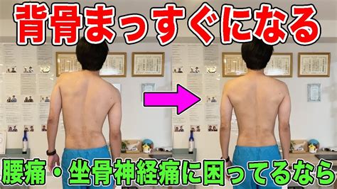 背骨が出ている痩せが気になるあなたへ：理想的な体を目指すためのガイド