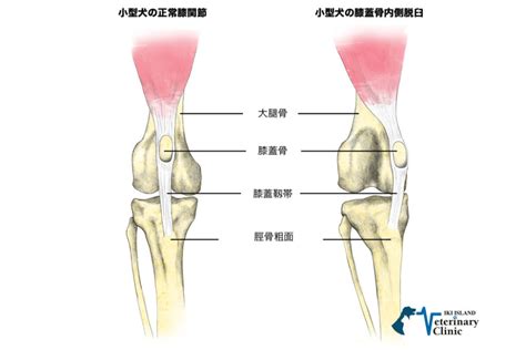 膝蓋骨脱臼（パテラ脱臼）: