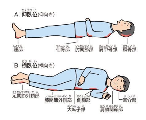 自宅でできる床ずれの治療法