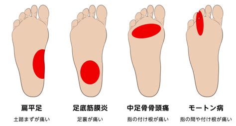 足の痛みと異常の包括ガイド