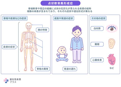 軟骨形成異形成症の症状：