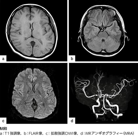 頭部の異常: