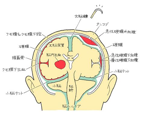 頭部：