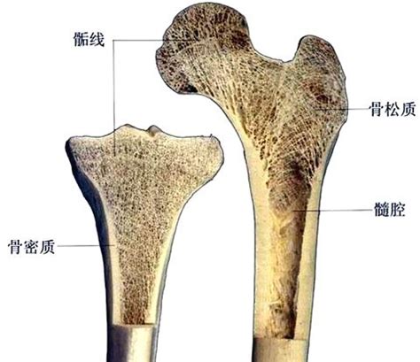 骨 воротник 简介