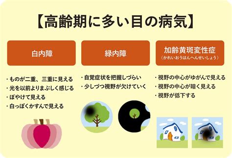 高速まばたきでわかる病気と改善策：役立つ全知識