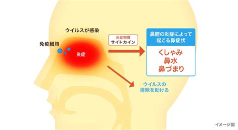 鼻症状：