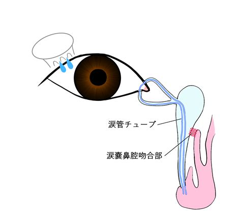 鼻腔損傷