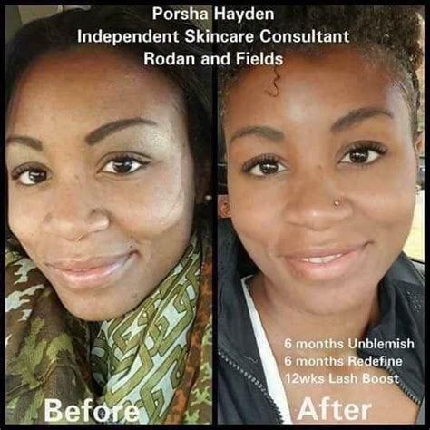  Redefine Your Skincare Journey: The Power of Obsidian 