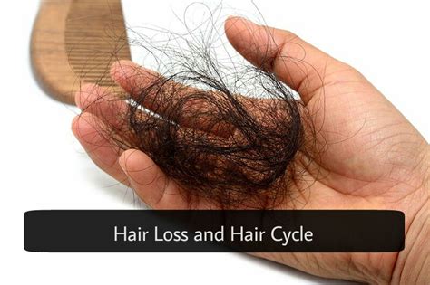  The Distress of Thinning Hair 