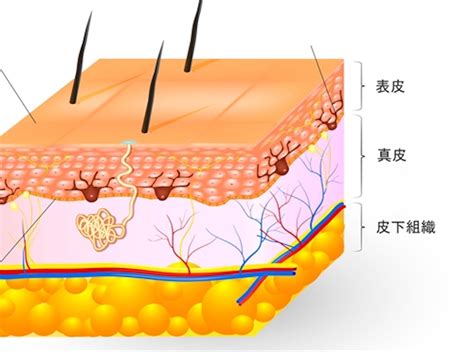 1. 皮膚炎