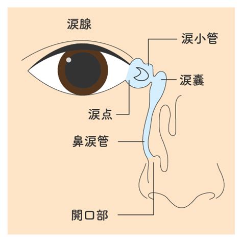 1. 鼻涙管の閉塞