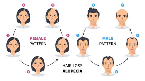 1. Androgenetic Alopecia: Male and Female Pattern Baldness