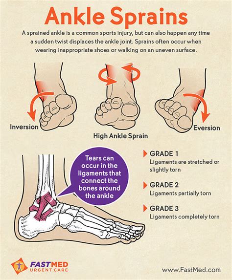 1. Ankle Sprains