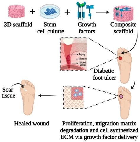 1. Biomedical Engineering: Skin for Wound Treatment