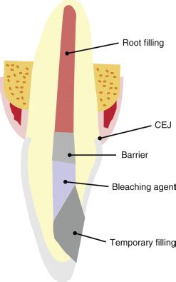 1. Bleaching Process