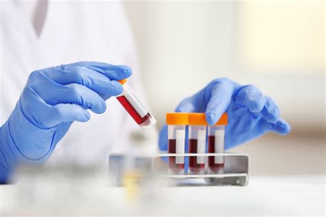 1. Blood test