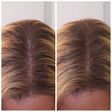 1. Conceal Hair Loss and Thinning Hair: