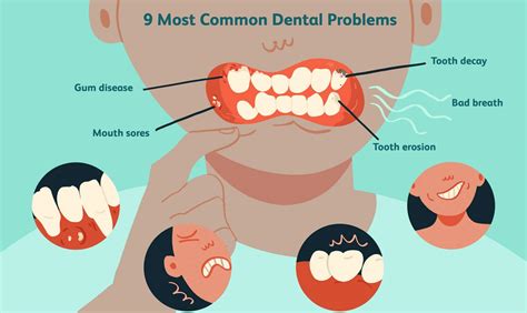 1. Dental Problems