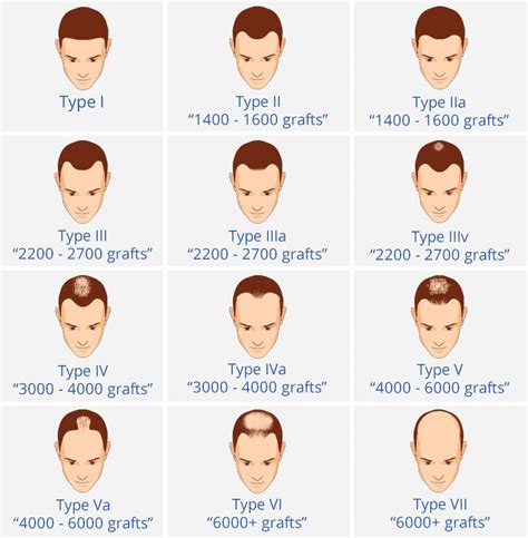 1. Determine Hair Loss Pattern: