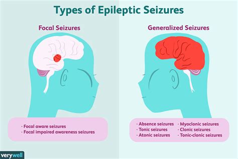 1. Epilepsy