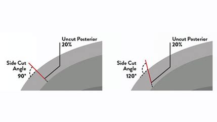 1. Flywire Precision Lace System: