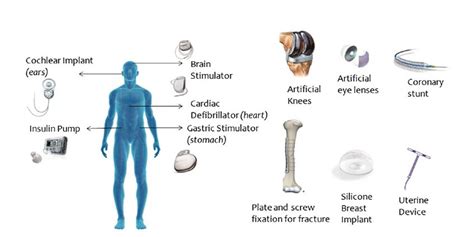 1. Implantable Devices: