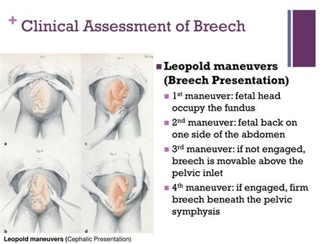 1. Inspect the Breech Area (5 Minutes)