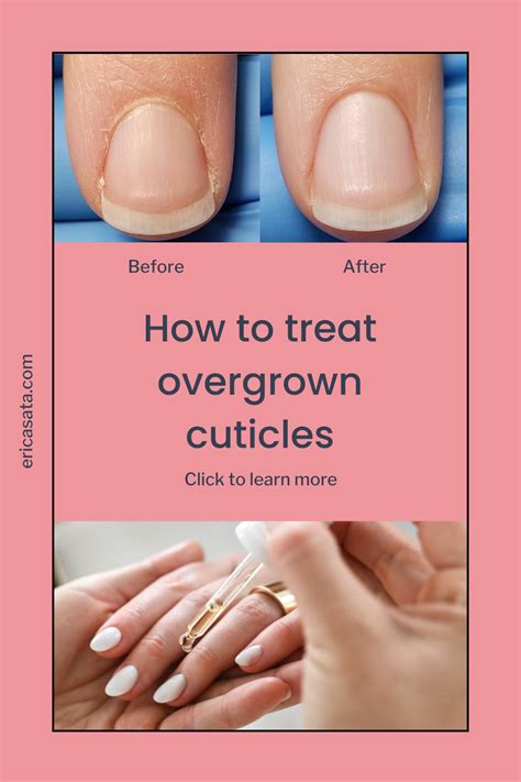 1. Overgrown Nails: