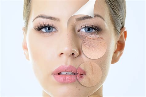 1. Reduction in Fine Lines and Wrinkles: