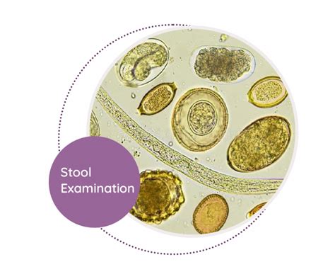 1. Shell Examination