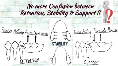 1. Support and Stability: