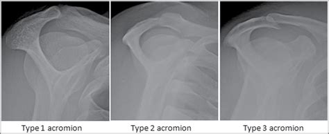 1. Type of X-ray: