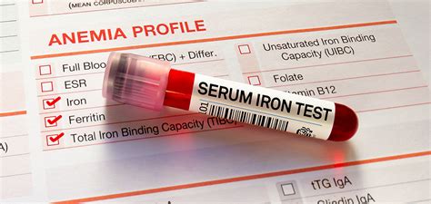 1. Types of Home Iron Tests 🧪