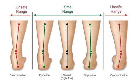 1. Understanding Your Foot Type and Needs
