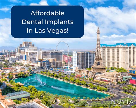 10,000+ Dental Implants in Las Vegas: The Ultimate Guide